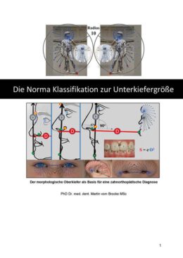 Brocke-Norma-Klassifikation-Unterkiefer